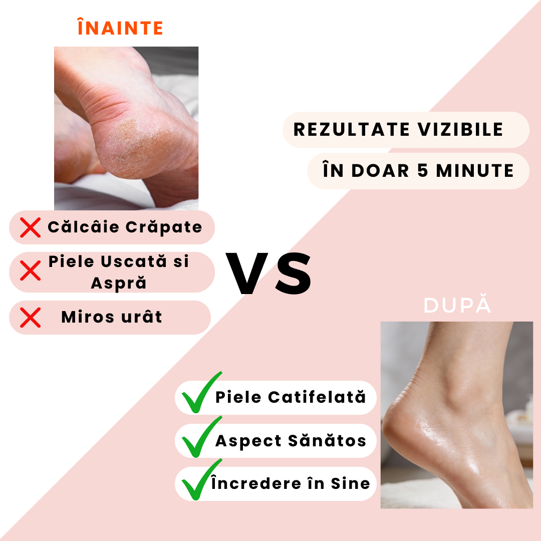 Aparat de picioare