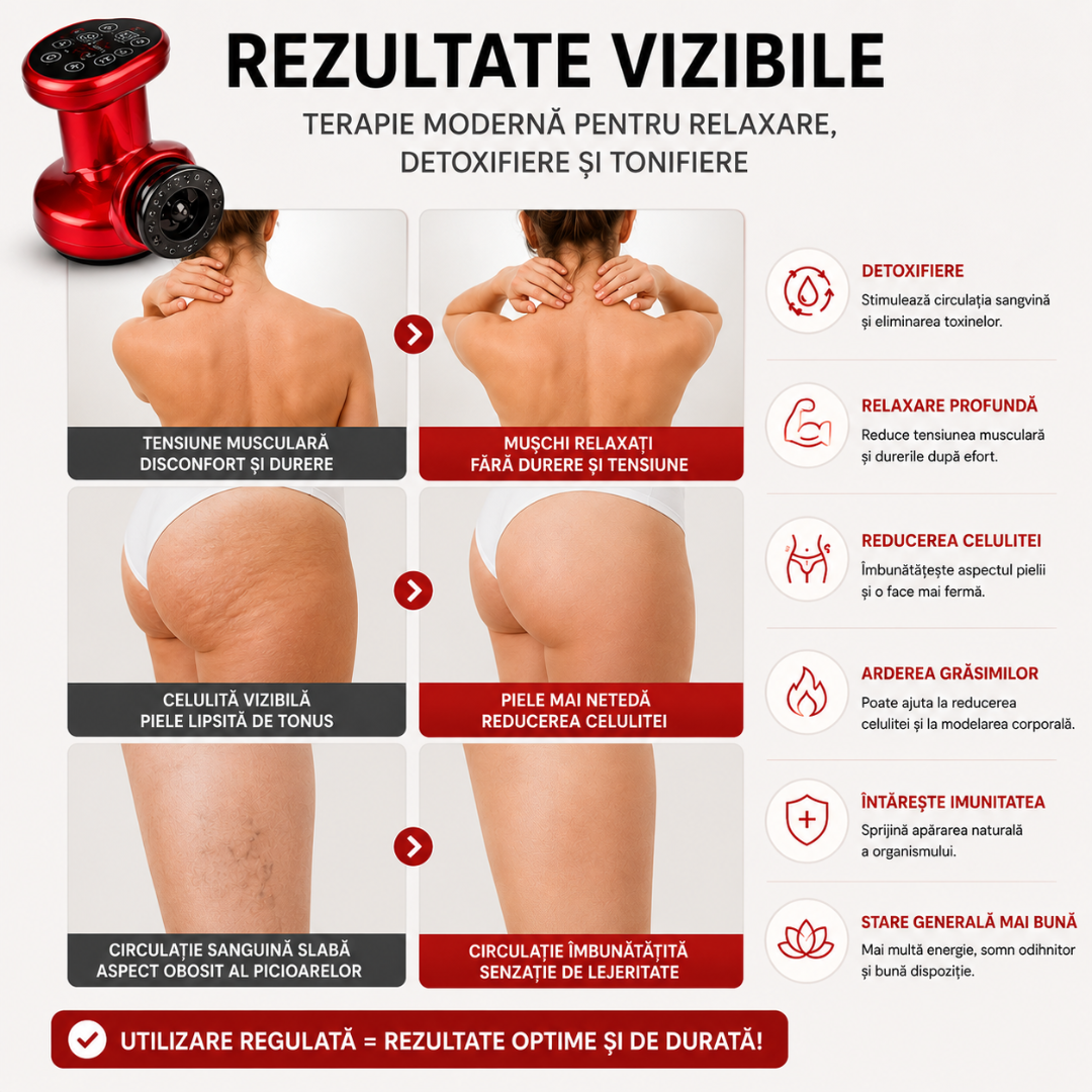 Aparat Electric Anticelulitic pentru Masaj și Remodelare Corporală